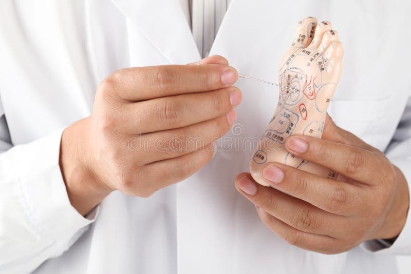 Acupuncture Medical Treatment. Stock Image Image of healer, needles