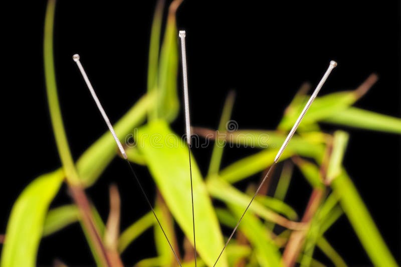 Acupuncture needles stock photo. Image of object, macro 27889396