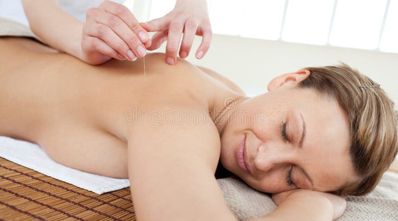 Acupuncture needles on a beautiful woman's back royalty free stock photography Acupuncture needles on a beautiful woman's back royalty free stock photography