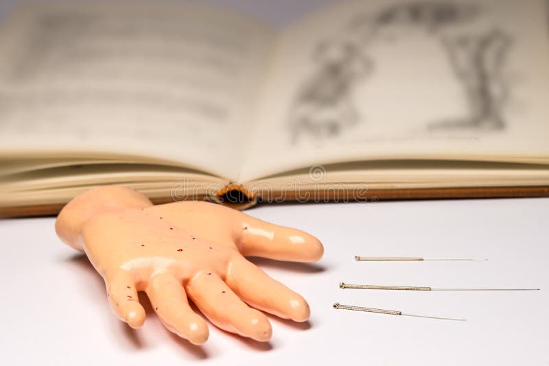 Acupuncture Needles with Hand Model Stock Photo Image of needles
