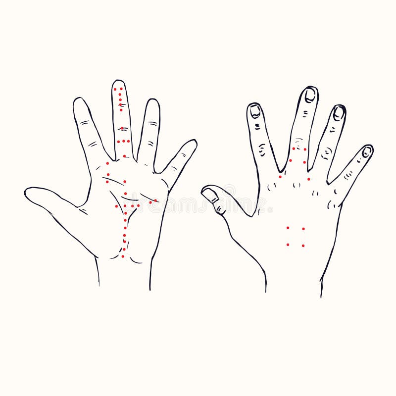 https://thumbs.dreamstime.com/b/acupuncture-scheme-red-points-hand-drawn-doodle-sketch-pop-art-style-black-white-medical-vector-acupuncture-scheme-187936100.jpg