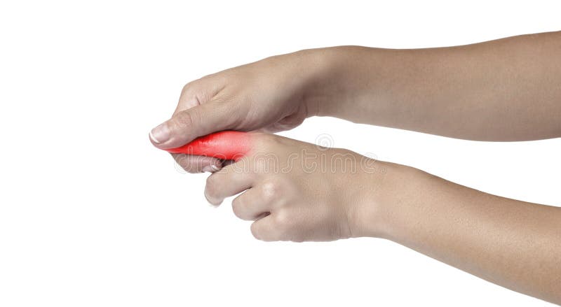 Acute Pain In A Woman Finger. Stock Image Image of hand