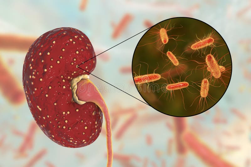 Acute pyelonephritis, medical concept, and close-up view of bacteria Escherichia coli, the common causative agent of kidney infection, 3D illustration