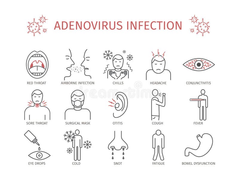 Adenovirusinfektion vektor vektor illustrationer. Illustration av
