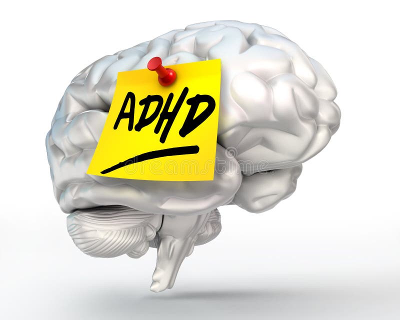 Adhd gele nota over hersenen royalty-vrije illustratie Adhd gele nota over hersenen royalty-vrije illustratie