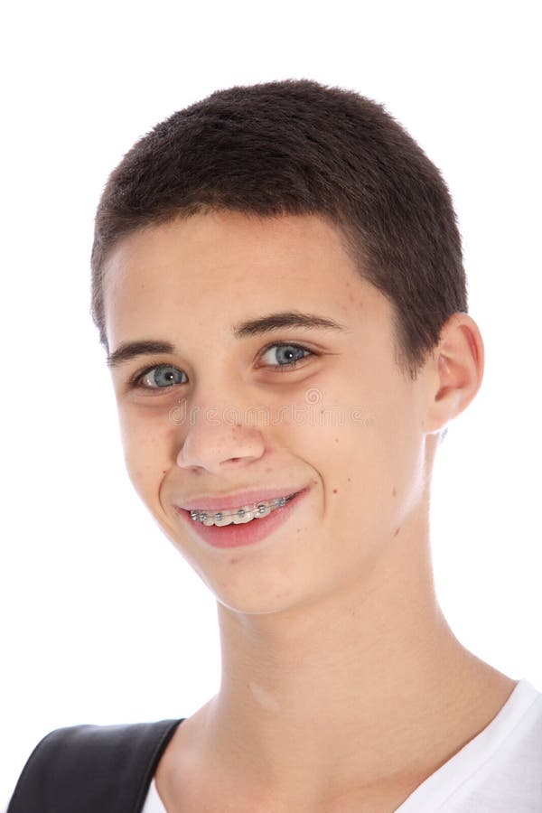 Brackets Mini Roth Bracket Ortodontici Mini Roth MBT 0.022" Con - Foto 3