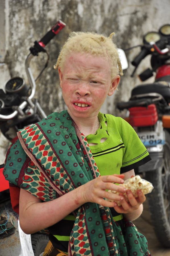 Africa albinos children portrait