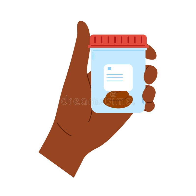 African hand holds bottle with stool analysis. Medical sample in a glass tube. Stool analysis vector illustration