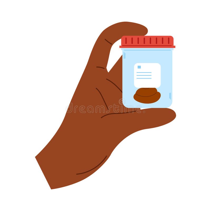 African hand holds laboratory container with excrement. Plastic container with feces sample royalty free illustration