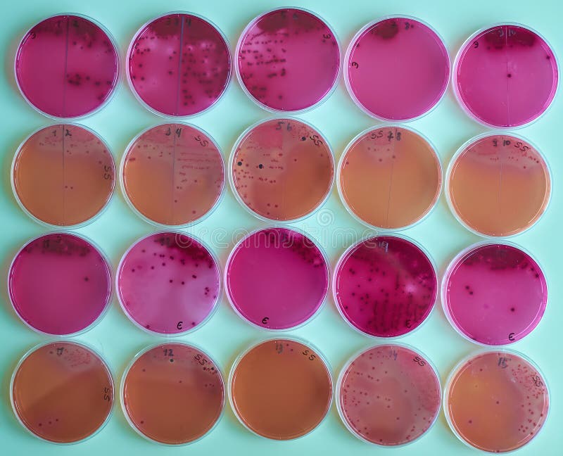 Bacteria Colonies on Selective Media Agar Plates in Various Petri Dish