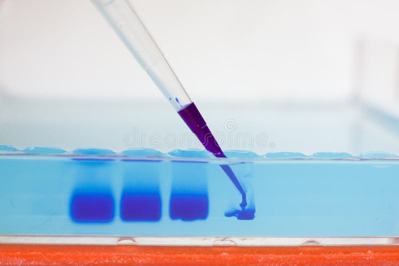 agarose gel ładowanie agarose gel ładowanie