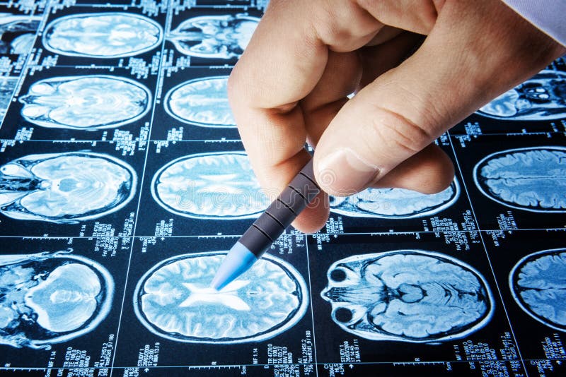 Aggiusti il punto un'immagine di un flusso di lavoro di risonanza magnetica cerebrale in hos diagnostici fotografie stock libere da diritti Aggiusti il punto un'immagine di un flusso di lavoro di risonanza magnetica cerebrale in hos diagnostici fotografie stock libere da diritti