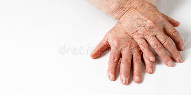 228 White Spots Nails Stock Photos - Free & Royalty-Free Stock Photos from Dreamstime 228 White Spots Nails Stock Photos - Free & Royalty-Free Stock Photos from Dreamstime