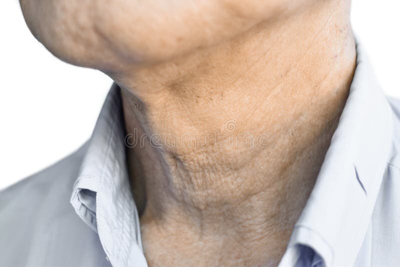 portrait retouching crease at arm portrait retouching crease at arm