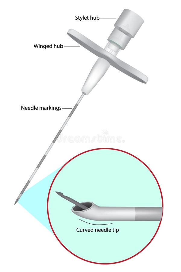 Tuohy Epidural Needle. Epidural administration Vector illustration. Tuohy Epidural Needle. Epidural administration Vector illustration