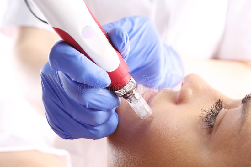 Beautician performs a needle mesotherapy treatment on a woman's face. Beautician performs a needle mesotherapy treatment on a woman's face