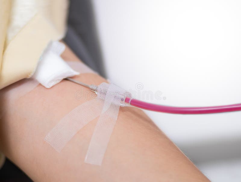 Aiguille Pour Le Don Du Sang Materiel Medical Photo Stock Image Du Pointeau Image 132062910