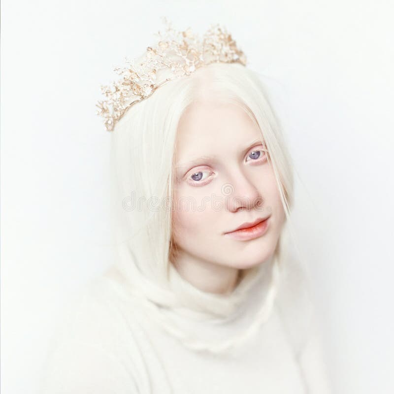 Albino female with crown and white long hair. Photo face on a light background. Blonde girl