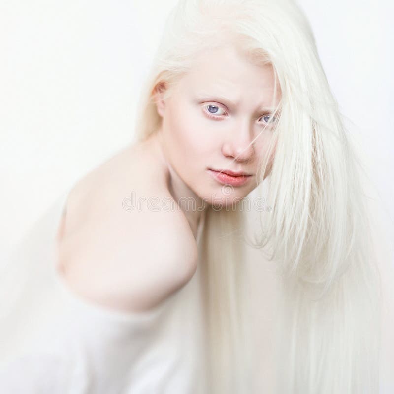 Albino female with white skin, natural lips and white hair. Photo face. Portrait of the head. Blonde girl. Blue eyes. Albino female with white skin, natural lips and white hair. Photo face. Portrait of the head. Blonde girl. Blue eyes.