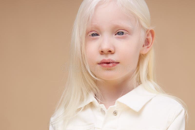 Albino Kid Girl with White Skin and White Hair Isolated Stock Image - Image  of beauty, eating: 183198483