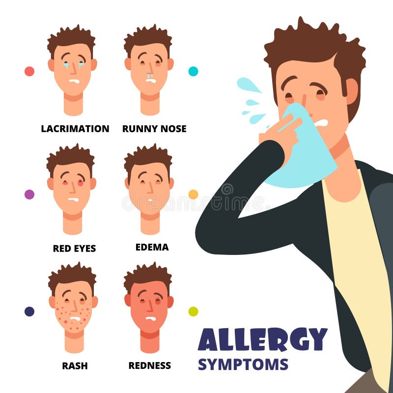 Alergia objawów wektorowa ilustracja - kreskówki medyczny infographic ilustracji Alergia objawów wektorowa ilustracja - kreskówki medyczny infographic ilustracji