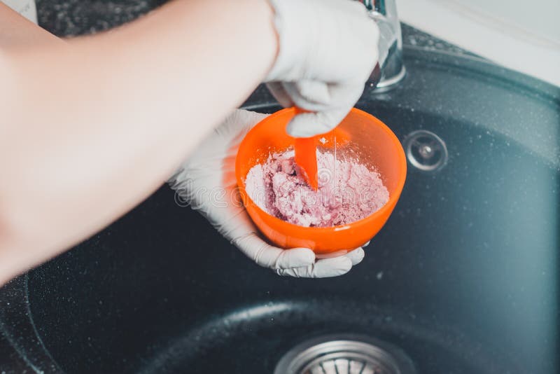 alginate impression records ndt alginate impression records ndt