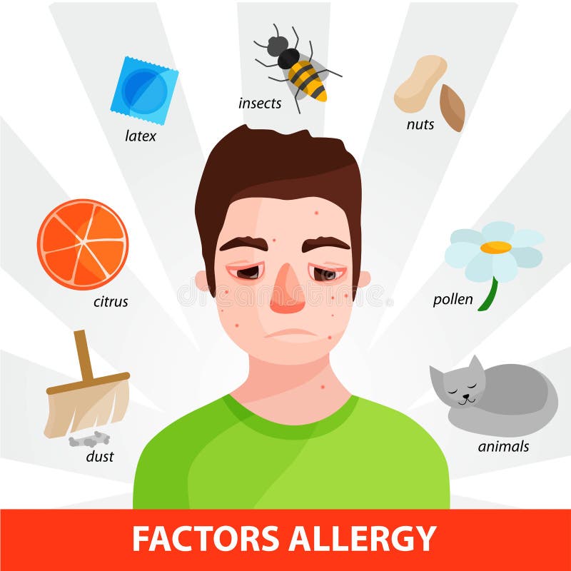 Allergie Infographic Vektor Vektor Abbildung Illustration von flach