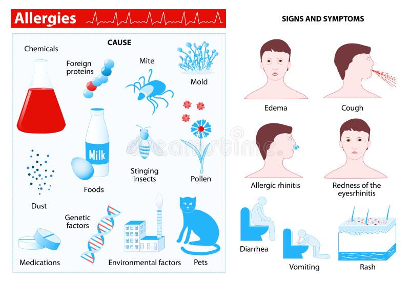 allergie Infographic