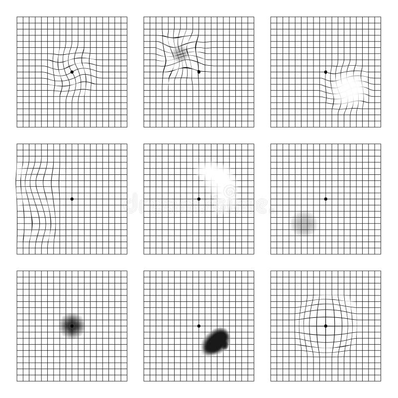 https://thumbs.dreamstime.com/b/amsler-eye-test-grid-oculist-vector-printable-chart-retina-examination-dot-centre-vision-control-check-220695012.jpg