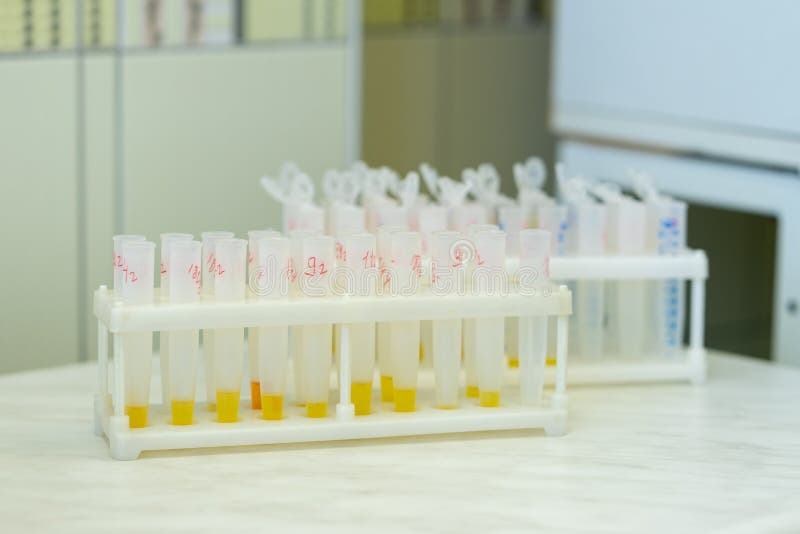 Analisi del sangue di conduzione in laboratorio immagine stock libera da diritti Analisi del sangue di conduzione in laboratorio immagine stock libera da diritti