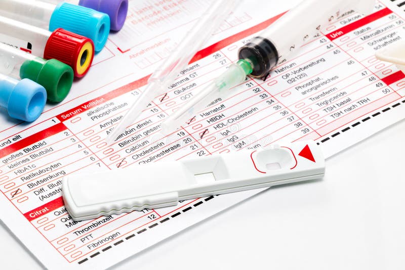 L'analisi Del Sangue, Campioni Di Sangue Su Un Laboratorio Si Forma