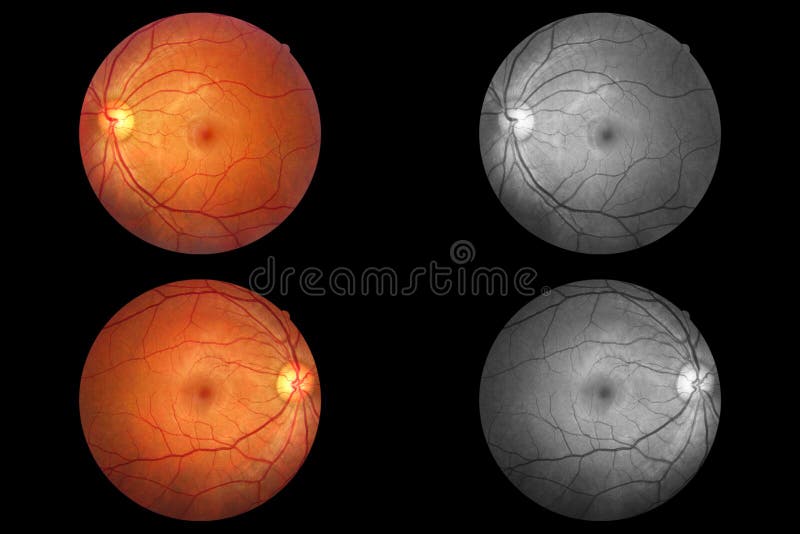 Anatomia dell'occhio umano, retina, arteria del disco ottico e vena ecc fotografia stock Anatomia dell'occhio umano, retina, arteria del disco ottico e vena ecc fotografia stock