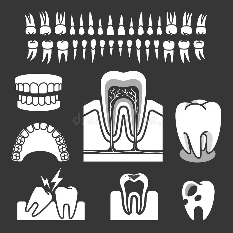 Anatomia humana do dente ilustração do vetor Anatomia humana do dente ilustração do vetor