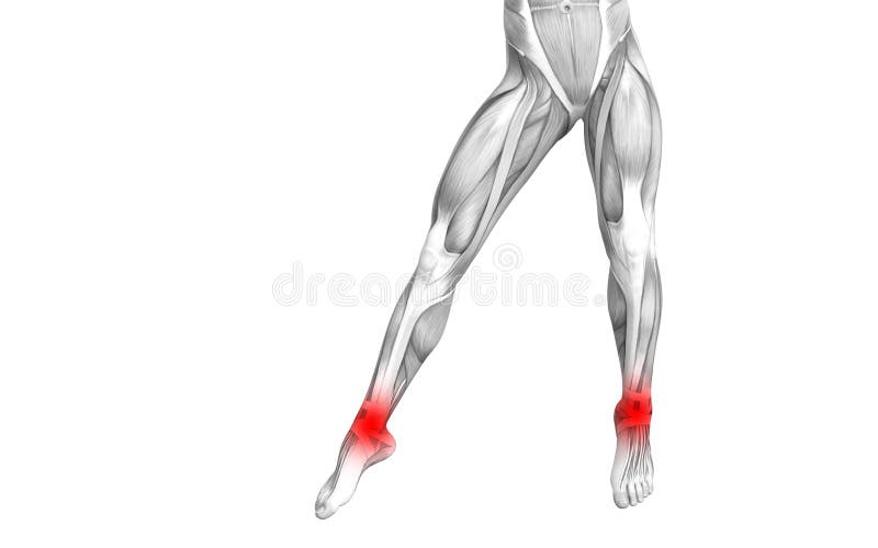 Anatomie humaine de cheville avec l'inflammation d'un rouge ardent de tache illustration stock Anatomie humaine de cheville avec l'inflammation d'un rouge ardent de tache illustration stock