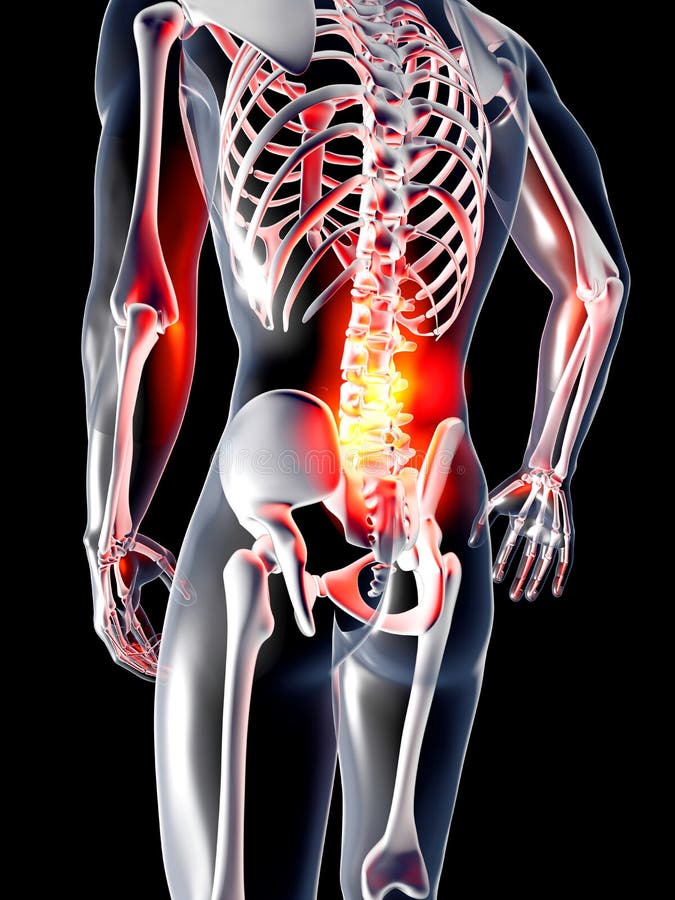 Anatomy - Back Pain stock illustration. Illustration of diagnosis
