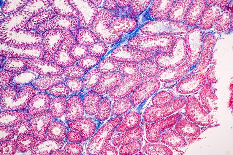 Histological Epididymis and Testis Human Cells Under Microscope. Stock ...