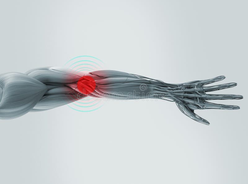 Anatomy model showing elbow pain. stock illustration Anatomy model showing elbow pain. stock illustration