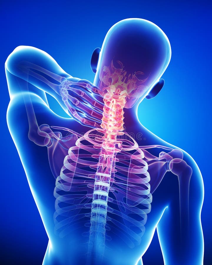 Anatomía del dolor de la parte posterior y de cuello del varón en azul