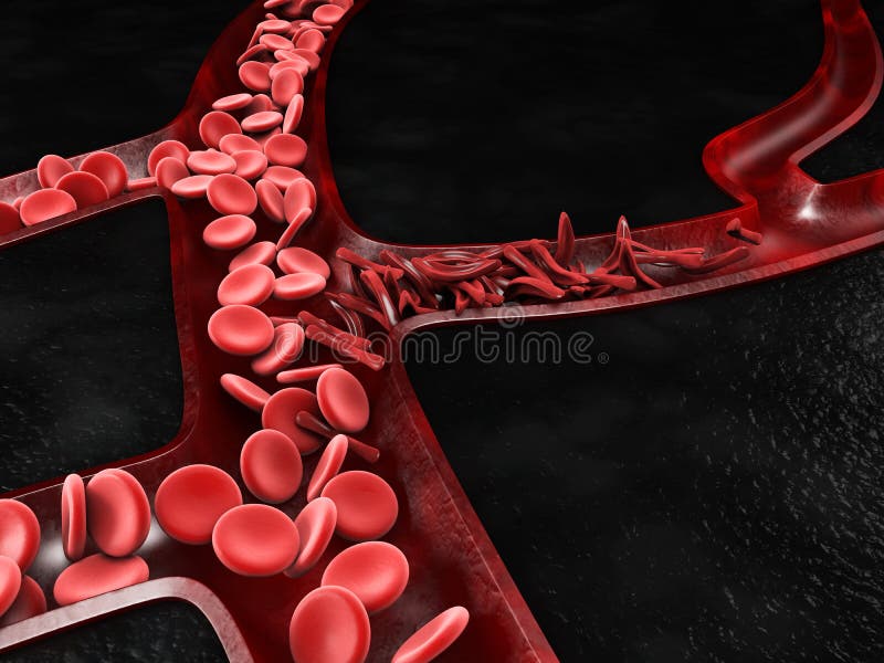 Anemia, sickle cell and normal red blood cell, 3d Illustration. Anemia, sickle cell and normal red blood cell, 3d Illustration