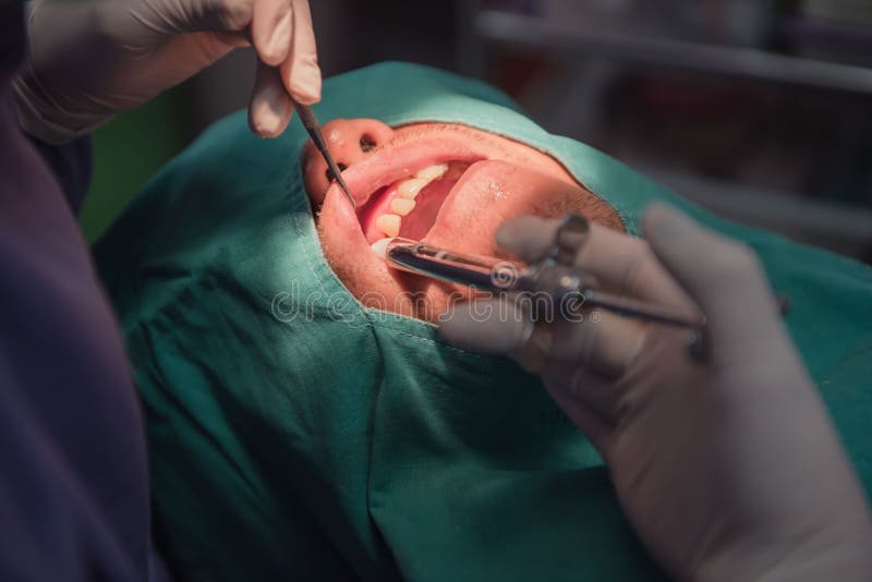 Anesthesie voor tandextractie door de tandarts Dentistry in het ziekenhuis stock fotografie Anesthesie voor tandextractie door de tandarts Dentistry in het ziekenhuis stock fotografie