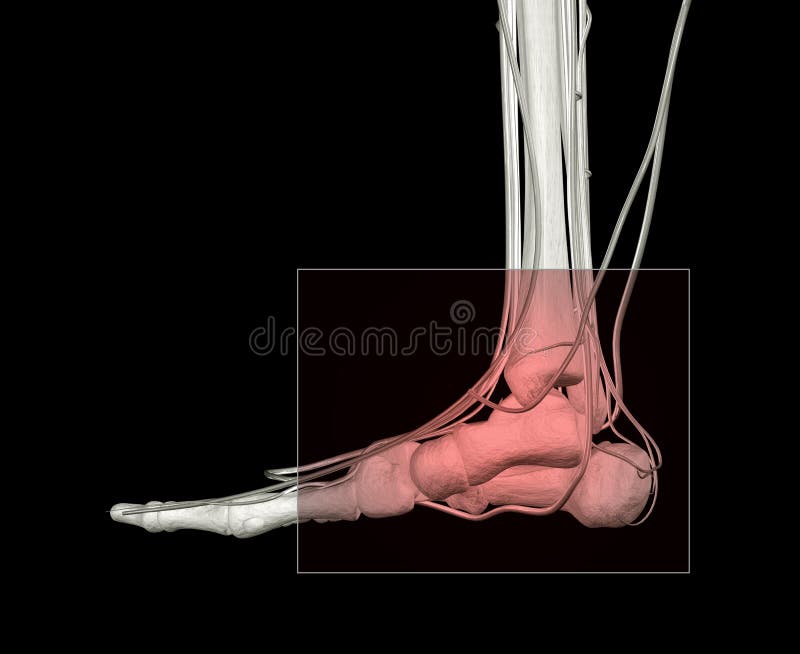 Ankle Injury