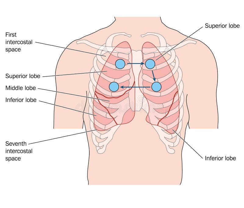 Drawing of the thorax showing the anterior lung position and sites for a stethoscope for lung auscultation. Created in Adobe Illustrator. Contains transparencies. EPS 10. Drawing of the thorax showing the anterior lung position and sites for a stethoscope for lung auscultation. Created in Adobe Illustrator. Contains transparencies. EPS 10.