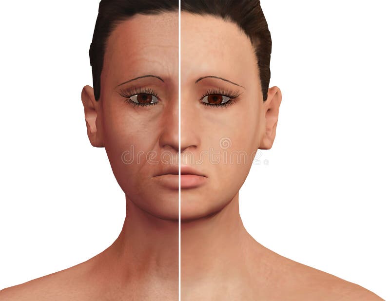 Antes e depois do processo estético de rejuvenescimento após a terapia de PRP Tratamento dermatological facial ilustração royalty free Antes e depois do processo estético de rejuvenescimento após a terapia de PRP Tratamento dermatological facial ilustração royalty free