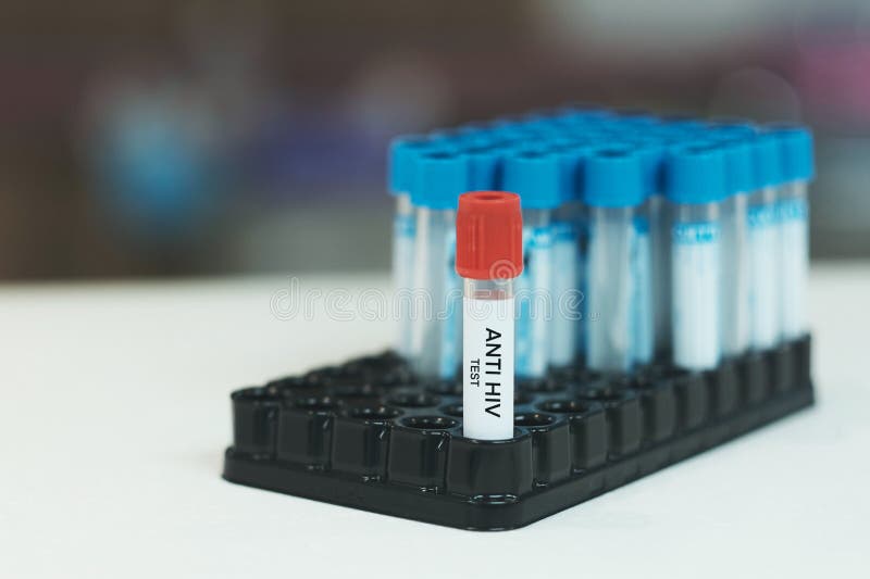 Anti HIV laboratory test