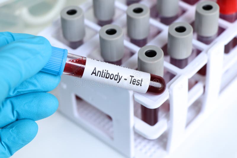 Antibody Test, Blood Sample To Analyze in the Laboratory Stock Image Image of chemical