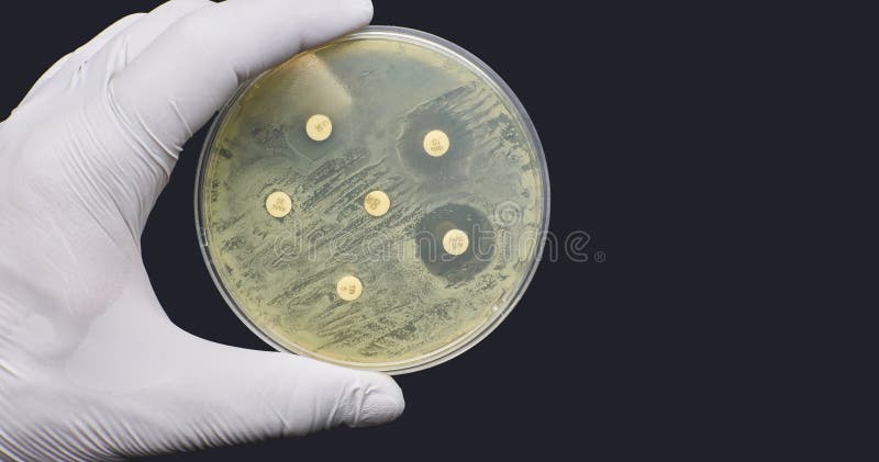 Antimicrobial Susceptibility Resistance Test by Diffusion on Black  Background Stock Image - Image of organism, analysis: 229981785