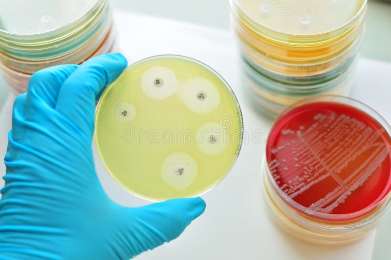antibacterial testing