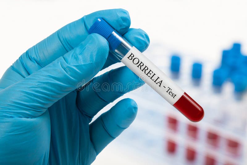 Análise de sangue do Borrelia foto de stock royalty free Análise de sangue do Borrelia foto de stock royalty free