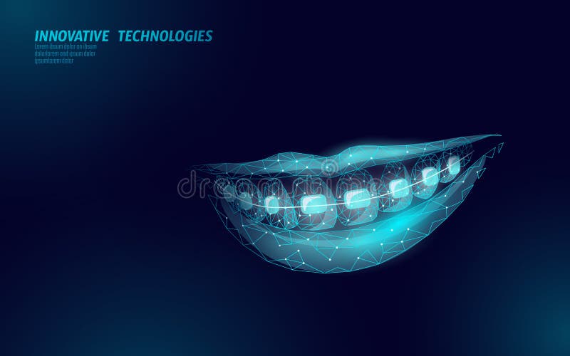 Braces - Dentistar