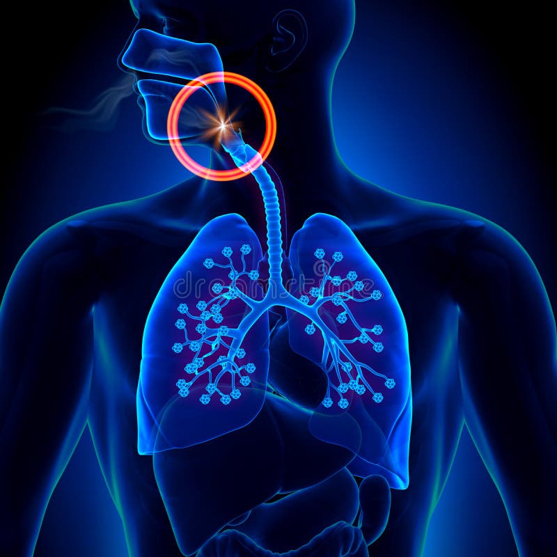 Apnea - Obstruction Sleep Apnea - anatomy. Apnea - Obstruction Sleep Apnea - anatomy